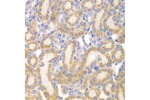 Immunohistochemistry of paraffin-embedded rat kidney using EYA3 antibody. (EYA3 anticorps  (AA 1-300))