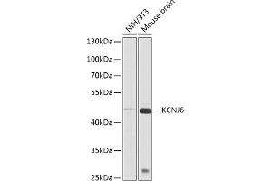 Western blot analysis of extracts of various cell lines, using KCNJ6 antibody (ABIN6129433, ABIN6142742, ABIN6142743 and ABIN6225263) at 1:1000 dilution.