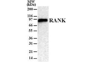 RANK Western Blot. (TNFRSF11A anticorps)