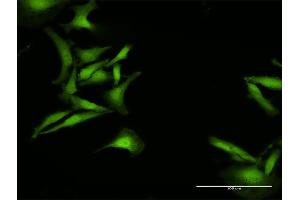 Immunofluorescence of purified MaxPab antibody to C1orf38 on HeLa cell. (C1orf38 anticorps  (AA 1-132))