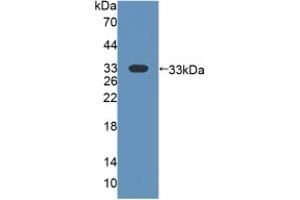 Detection of Recombinant FMO2, Human using Polyclonal Antibody to Flavin Containing Monooxygenase 2, Non Functional (FMO2) (FMO2 anticorps  (AA 295-469))