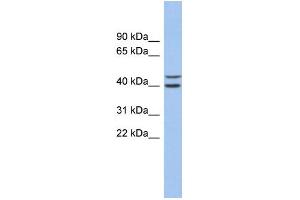 WB Suggested Anti-FBXL14 Antibody Titration: 0. (FBXL14 anticorps  (N-Term))