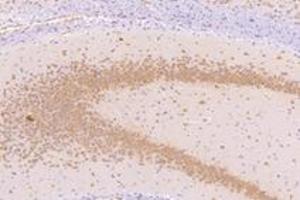 Immunohistochemistry analysis of paraffin-embedded mouse substantia nigra using NMU (ABIN7074818) at dilution of 1: 1000 (Neuromedin U anticorps)