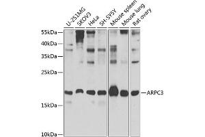 Western blot analysis of extracts of various cell lines, using  Antibody (ABIN6129197, ABIN6137129, ABIN6137130 and ABIN6223718) at 1:1000 dilution.