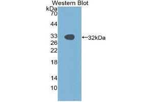 Western Blotting (WB) image for anti-P21-Activated Kinase 1 (PAK1) (AA 252-501) antibody (ABIN1869663) (PAK1 anticorps  (AA 252-501))