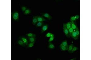 Immunofluorescence staining of HepG2 cells with ABIN7127730 at 1:100,counter-stained with DAPI.