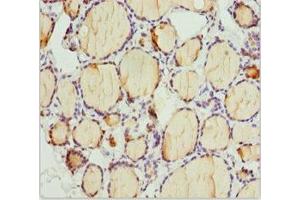 Immunohistochemistry of paraffin-embedded human thyroid tissue using ABIN7163636 at dilution of 1:100 (PLEKHA1 anticorps  (AA 285-404))