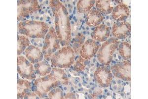 Used in DAB staining on fromalin fixed paraffin- embedded kidney tissue