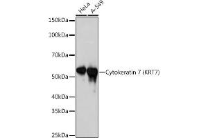 Western blot analysis of extracts of various cell lines, using Cytokeratin 7 (KRT7) (KRT7) Rabbit mAb  at 1:1000 dilution. (Cytokeratin 7 anticorps)