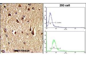 (LEFT)Formalin-fixed and paraffin-embedded human brain tissue reacted with FKHR Antibody (Center ), which was peroxidase-conjugated to the secondary antibody, followed by DAB staining.
