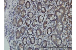 Immunoperoxidase of monoclonal antibody to PCSK1 on formalin-fixed paraffin-embedded human small Intestine.