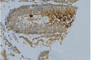 ABIN6269225 at 1/100 staining Mouse testis tissue by IHC-P.