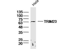 Hela lysates probed with TRIM23 Polyclonal Antibody, Unconjugated  at 1:300 dilution and 4˚C overnight incubation. (TRIM23 anticorps  (AA 201-300))