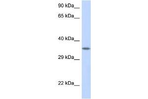WB Suggested Anti-CRK Antibody Titration: 1. (Crk anticorps  (C-Term))