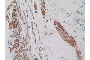 IHC-P analysis of Human Stomach Tissue, with DAB staining. (VEGFR2/CD309 anticorps  (AA 46-320))