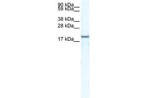 WB Suggested Anti-CXCL14 Antibody Titration:  5. (CXCL14 anticorps  (Middle Region))