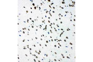 Anti-SHC antibody, IHC(F): Rat Brain Tissue