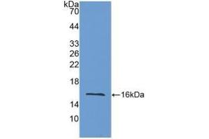 Detection of Recombinant LOXL2, Mouse using Polyclonal Antibody to Lysyl Oxidase Like Protein 2 (LOXL2) (LOXL2 anticorps  (AA 53-160))
