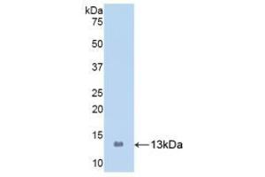Detection of Recombinant S100A8, Human using Polyclonal Antibody to S100 Calcium Binding Protein A8 (S100A8) (S100A8 anticorps  (AA 1-93))