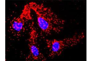Proximity Ligation Analysis of protein-protein interactions between TRAF2 and ACTG1.