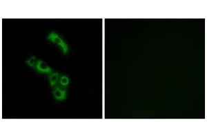 Immunofluorescence analysis of A549 cells, using C1QB antibody. (C1QB anticorps  (C-Term))