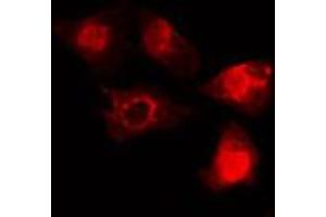 ABIN6268665 staining HeLa cells by IF/ICC.