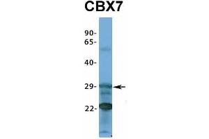Host:  Rabbit  Target Name:  CBX7  Sample Type:  293T  Antibody Dilution:  1. (CBX7 anticorps  (Middle Region))