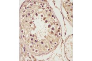 (ABIN6243400 and ABIN6578788) staining NSFL1C in human testis tissue sections by Immunohistochemistry (IHC-P - paraformaldehyde-fixed, paraffin-embedded sections).