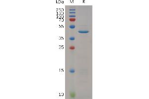 Mouse RN Protein, hFc Tag on SDS-PAGE under reducing condition.