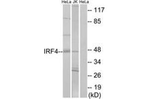 Western blot analysis of extracts from HeLa/Jurkat cells, using IRF4 Antibody. (IRF4 anticorps  (AA 281-330))