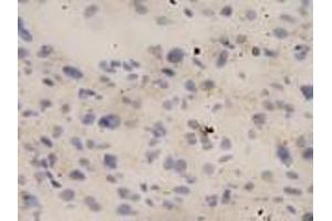 IHC-P analysis of human liver tissue, using IL18 antibody (1/10 dilution).