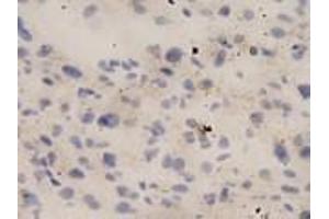IHC-P analysis of human liver tissue, using IL18 antibody (1/10 dilution). (IL-18 anticorps  (full length))