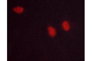ABIN6268641 staining lovo cells by ICC/IF. (NF-kB p65 anticorps)