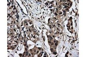 Immunohistochemistry (IHC) image for anti-Dicarbonyl/L-Xylulose Reductase (DCXR) antibody (ABIN1497785) (DCXR anticorps)