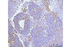 IHC analysis of Collagen VI/COL6A2 using anti-Collagen VI/COL6A2 antibody (ABIN7601439).