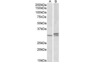 ABIN570860 (1µg/ml) staining of Mouse and Rat Spinal Cord lysates (35µg protein in RIPA buffer). (HOXA9 anticorps  (AA 37-50))