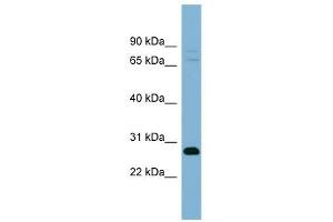 TMEM176A antibody used at 1 ug/ml to detect target protein. (TMEM176A anticorps  (Middle Region))