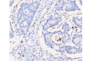 IHC analysis of Grancalcin/GCA using anti-Grancalcin/GCA antibody (ABIN6719568). (Grancalcin anticorps  (AA 42-217))