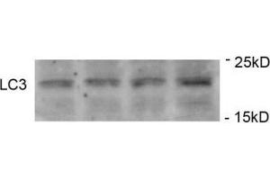 Immunoblots of SH-SY5Y cells treated with MPP+ for 24h was probed with phospho-LC3C antibody. (LC3C anticorps  (pSer12))