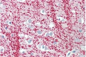 ABIN571099 (3. (Tppp anticorps  (Internal Region))