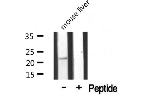 MRPL20 Antikörper  (C-Term)