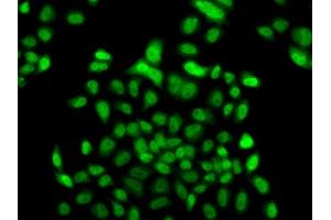 Immunofluorescence analysis of  cells using FBXO7 antibody (ABIN6130383, ABIN6140527, ABIN6140528 and ABIN6223349). (FBXO7 anticorps  (AA 353-522))