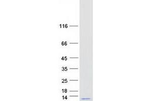 Validation with Western Blot