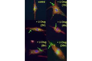 Immunofluorescence (IF) image for anti-Microtubule-Associated Protein 1 Light Chain 3 beta (MAP1LC3B) (cleaved) antibody (ABIN2999910)