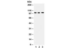 Western blot testing of 1) human HeLa, 2) Raji and 3) U937 lysate with ITCH antibody.