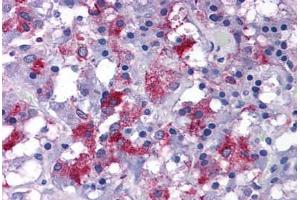 Human Adrenal: Formalin-Fixed, Paraffin-Embedded (FFPE) (EFCAB4B anticorps  (C-Term))