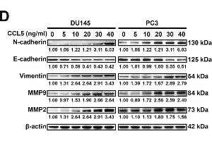 CCL5 promotes the invasion and the PCSCs subpopulation of prostate cancer cells in vitro.