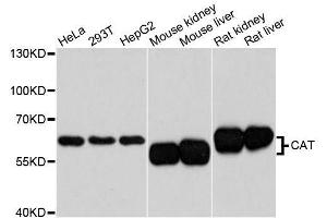 Western blot analysis of extracts of various cell lines, using CAT antibody. (Catalase anticorps  (AA 1-225))