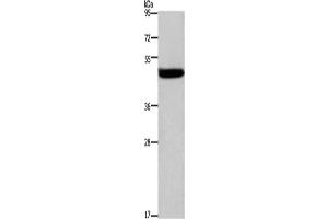 Western Blotting (WB) image for anti-Cathepsin E (CTSE) antibody (ABIN2427901) (Cathepsin E anticorps)