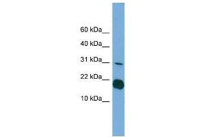 WB Suggested Anti-IL1F5 Antibody Titration: 0.